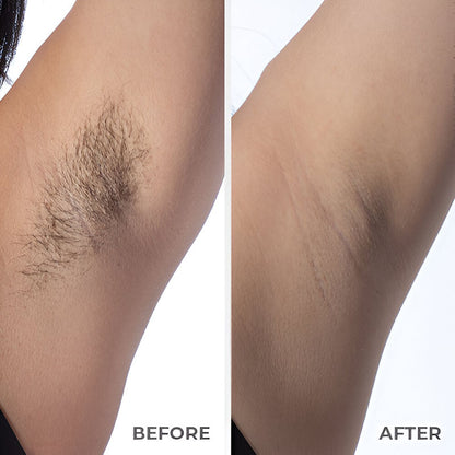 Painless Hair Removal Cream