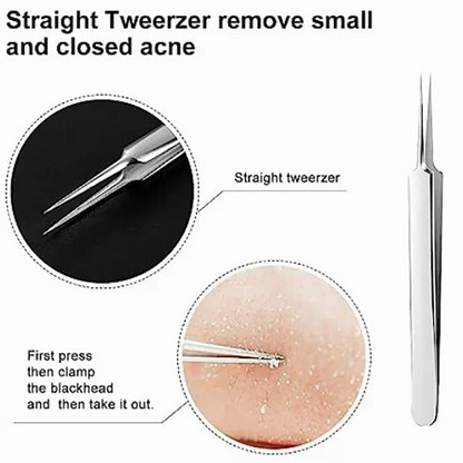 Professional Facial Blackhead Remover Tweezers