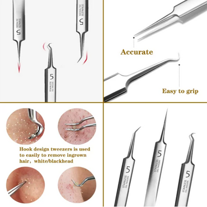 Professional Facial Blackhead Remover Tweezers