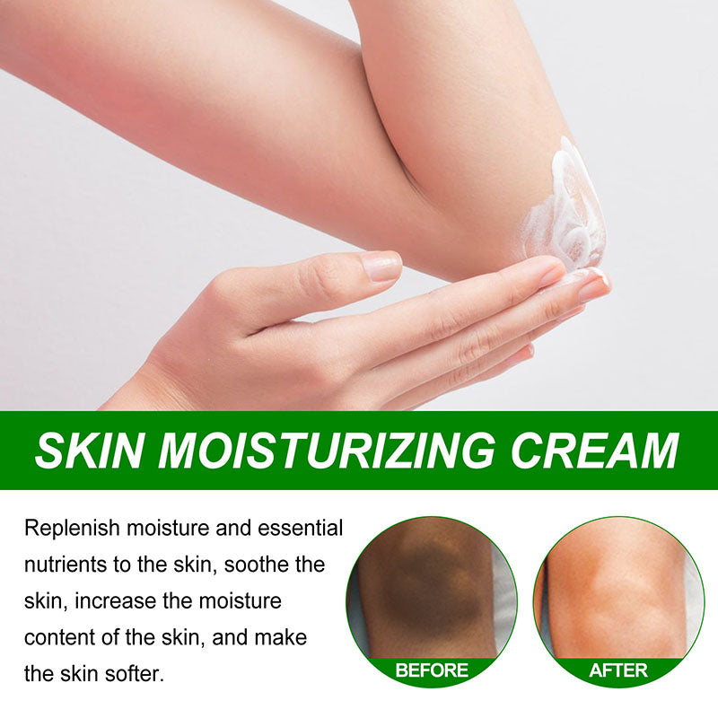 Skin whitening cream